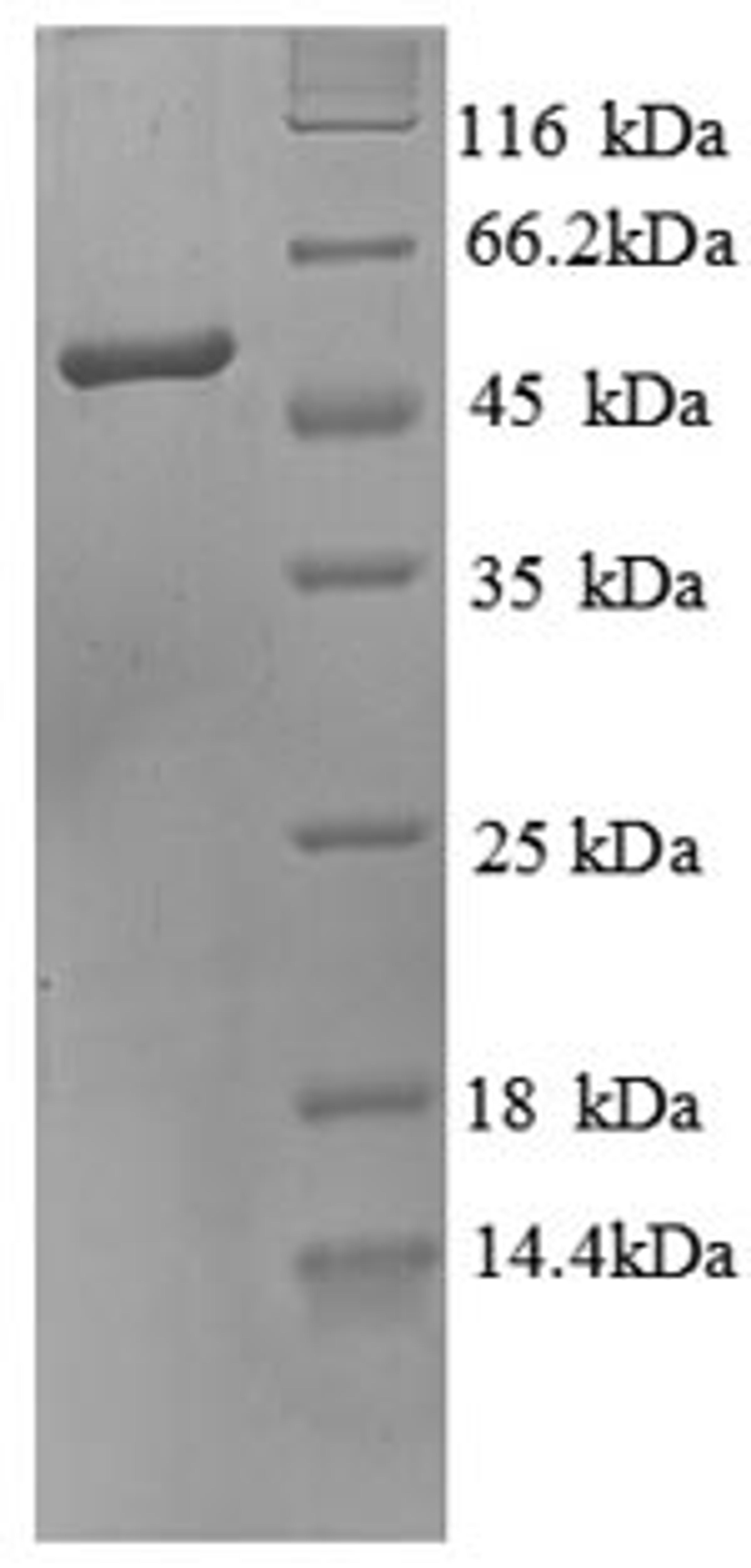 (Tris-Glycine gel) Discontinuous SDS-PAGE (reduced) with 5% enrichment gel and 15% separation gel.