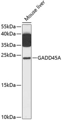 Western blot - GADD45A antibody (A13486)