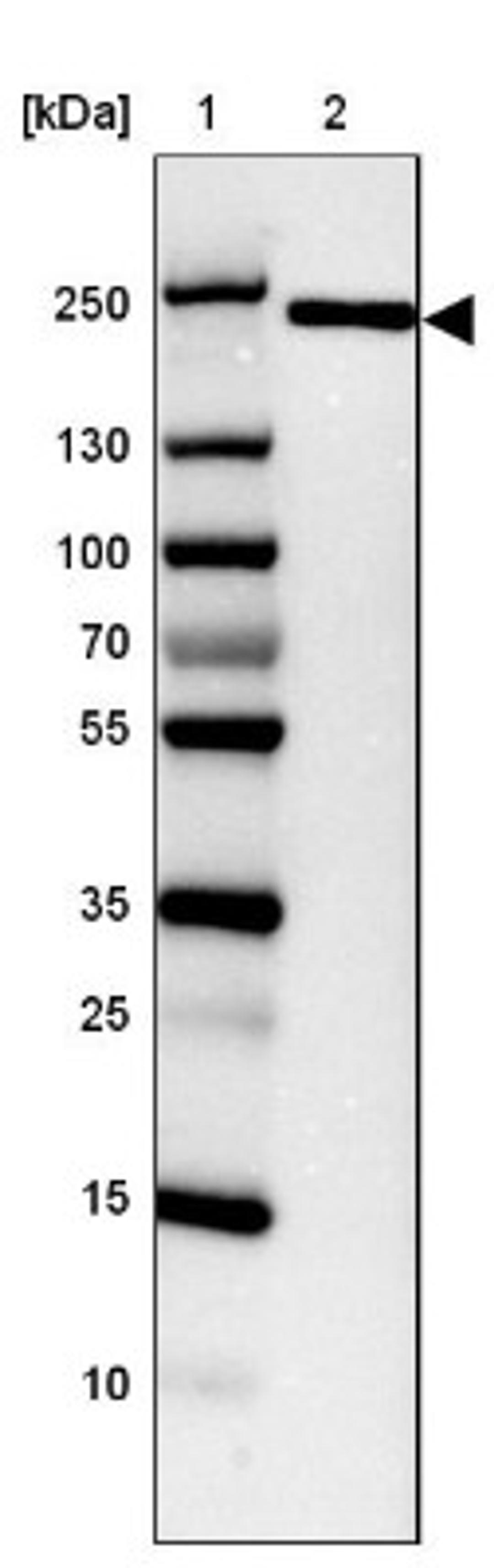 Western Blot: BCL9-2 Antibody [NBP2-14350] - Lane 1: Marker [kDa] 250, 130, 100, 70, 55, 35, 25, 15, 10<br/>Lane 2: CACO-2