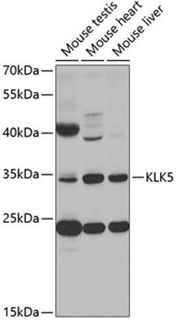 Western blot - KLK5 antibody (A2991)