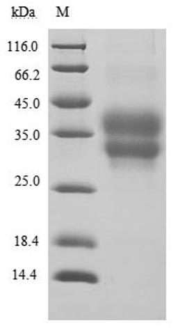 (Tris-Glycine gel) Discontinuous SDS-PAGE (reduced) with 5% enrichment gel and 15% separation gel.