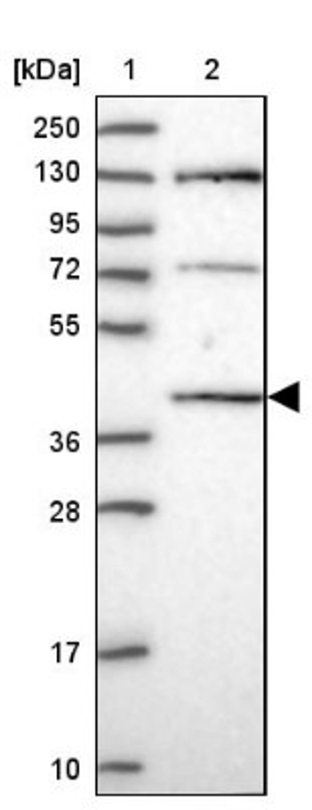 Western Blot: C6orf163 Antibody [NBP1-94165] - Lane 1: Marker [kDa] 250, 130, 95, 72, 55, 36, 28, 17, 10<br/>Lane 2: Human cell line RT-4