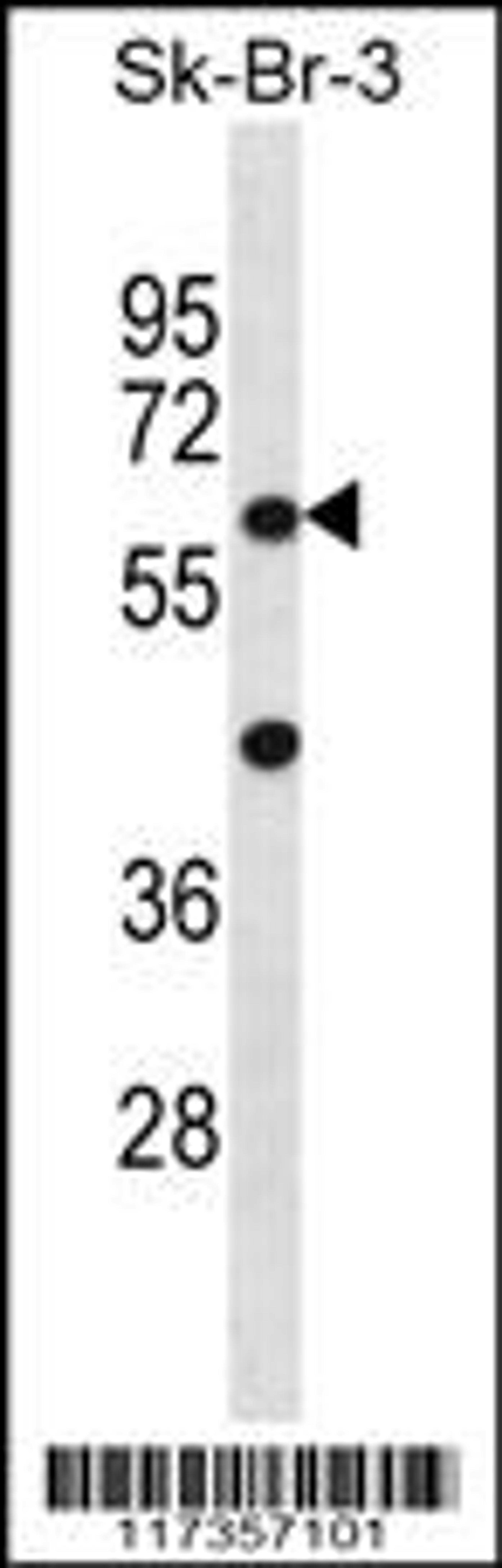 Western blot analysis in SK-BR-3 cell line lysates (35ug/lane).