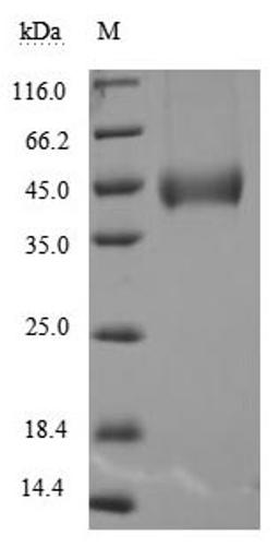 (Tris-Glycine gel) Discontinuous SDS-PAGE (reduced) with 5% enrichment gel and 15% separation gel.