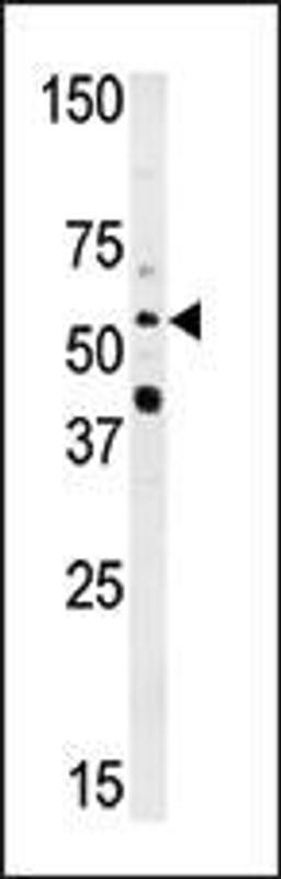 Western blot analysis of anti-NMT2 Pab in HepG2 cell line lysate (35ug/lane)