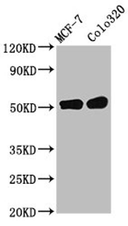 Western Blot. Positive WB detected in: MCF-7 whole cell lysate, Colo320 whole cell lysate. All lanes: DMAP1 antibody at 11µg/ml. Secondary. Goat polyclonal to rabbit IgG at 1/50000 dilution. Predicted band size: 53 kDa. Observed band size: 53 kDa
