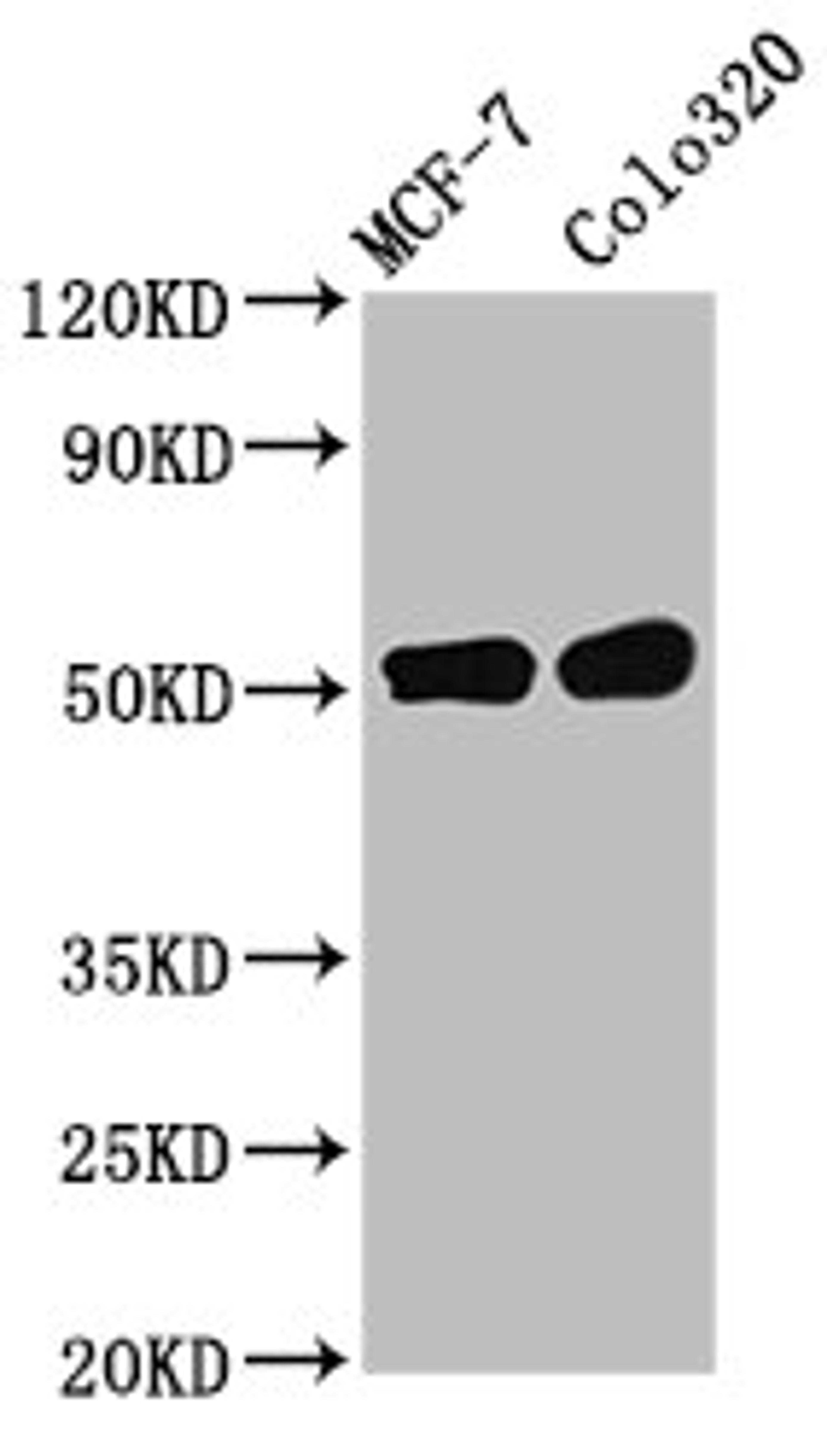 Western Blot. Positive WB detected in: MCF-7 whole cell lysate, Colo320 whole cell lysate. All lanes: DMAP1 antibody at 11µg/ml. Secondary. Goat polyclonal to rabbit IgG at 1/50000 dilution. Predicted band size: 53 kDa. Observed band size: 53 kDa