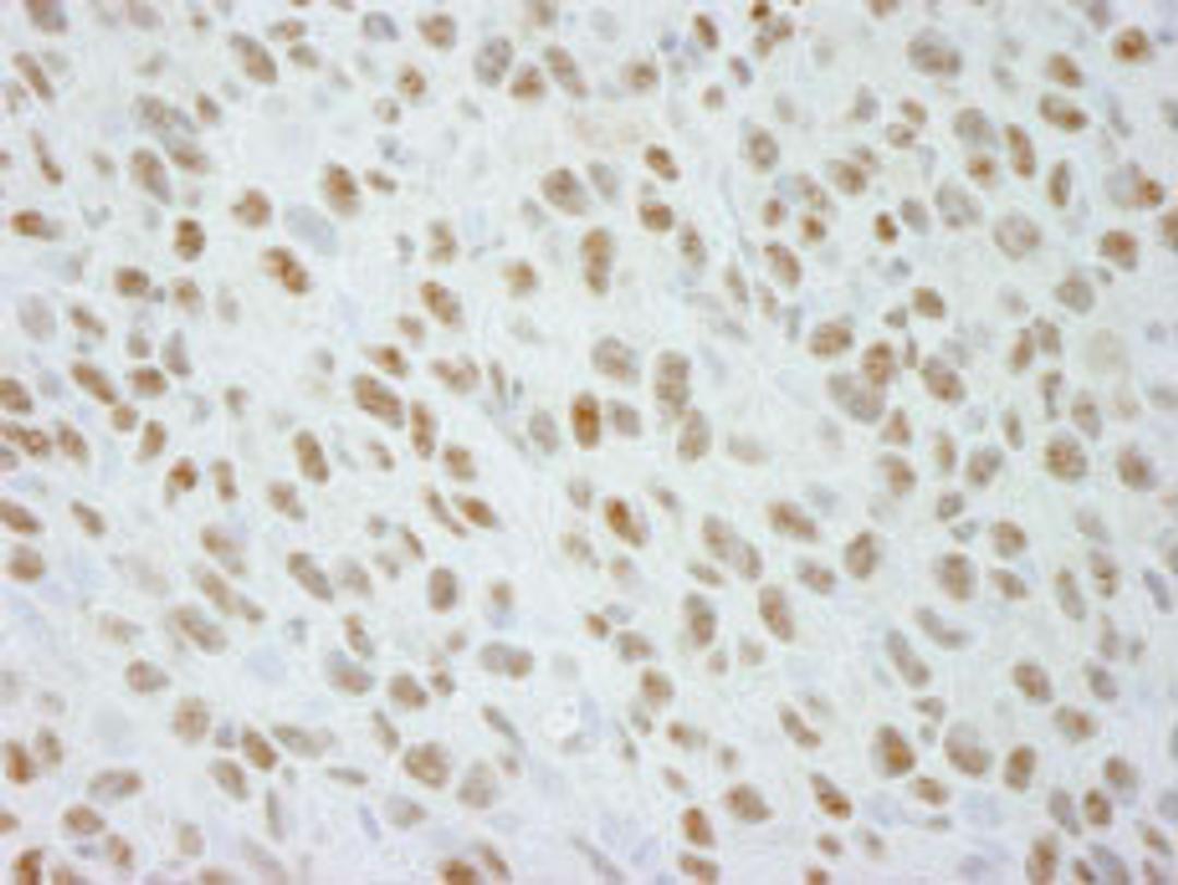 Detection of mouse DDX21 by immunohistochemistry.