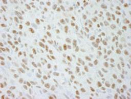 Detection of mouse DDX21 by immunohistochemistry.