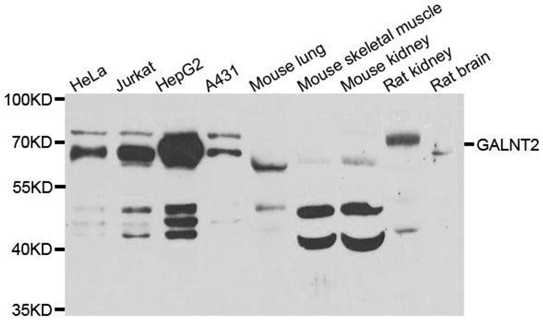 Western blot analysis of extracts of various cell lines using GALNT2 antibody