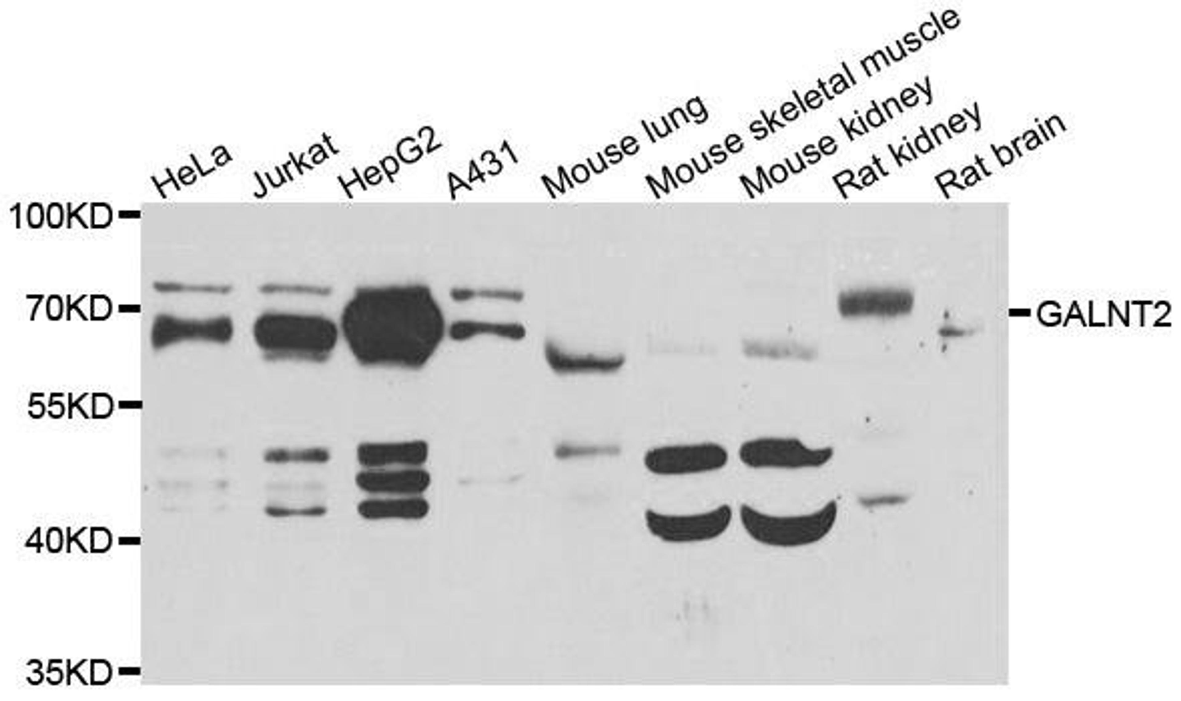 Western blot analysis of extracts of various cell lines using GALNT2 antibody