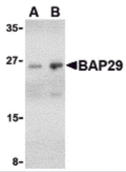 Western blot analysis of Bap29 in human heart tissue lysate with Bap29 antibody at (A) 1 and (B) 2 &#956;g/mL.