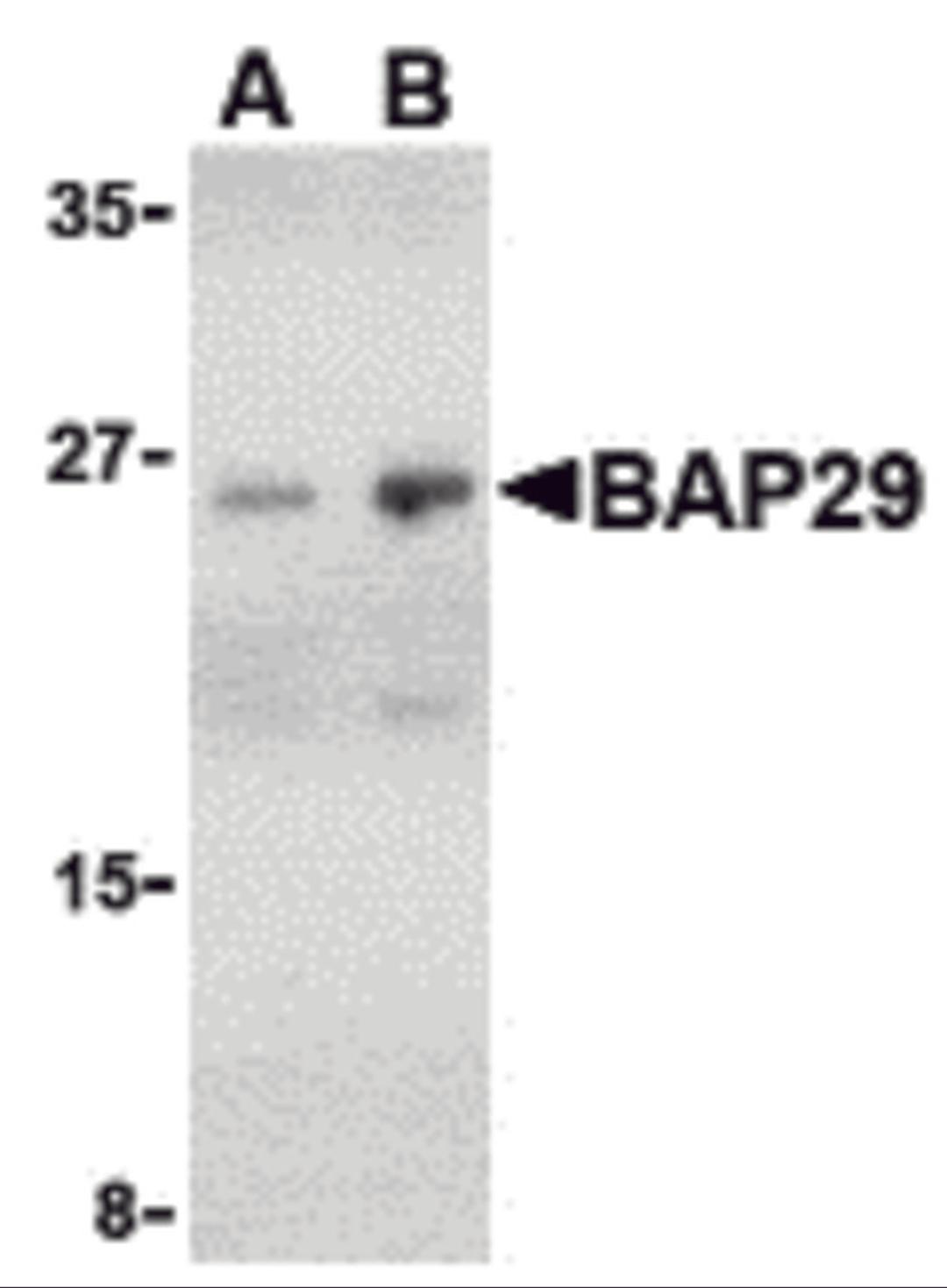 Western blot analysis of Bap29 in human heart tissue lysate with Bap29 antibody at (A) 1 and (B) 2 μg/mL.