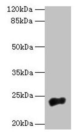 Western blot. All lanes: NACA2 antibody at 5µg/ml + 293T whole cell lysate. Secondary. Goat polyclonal to rabbit IgG at 1/10000 dilution. Predicted band size: 24 kDa. Observed band size: 24 kDa
