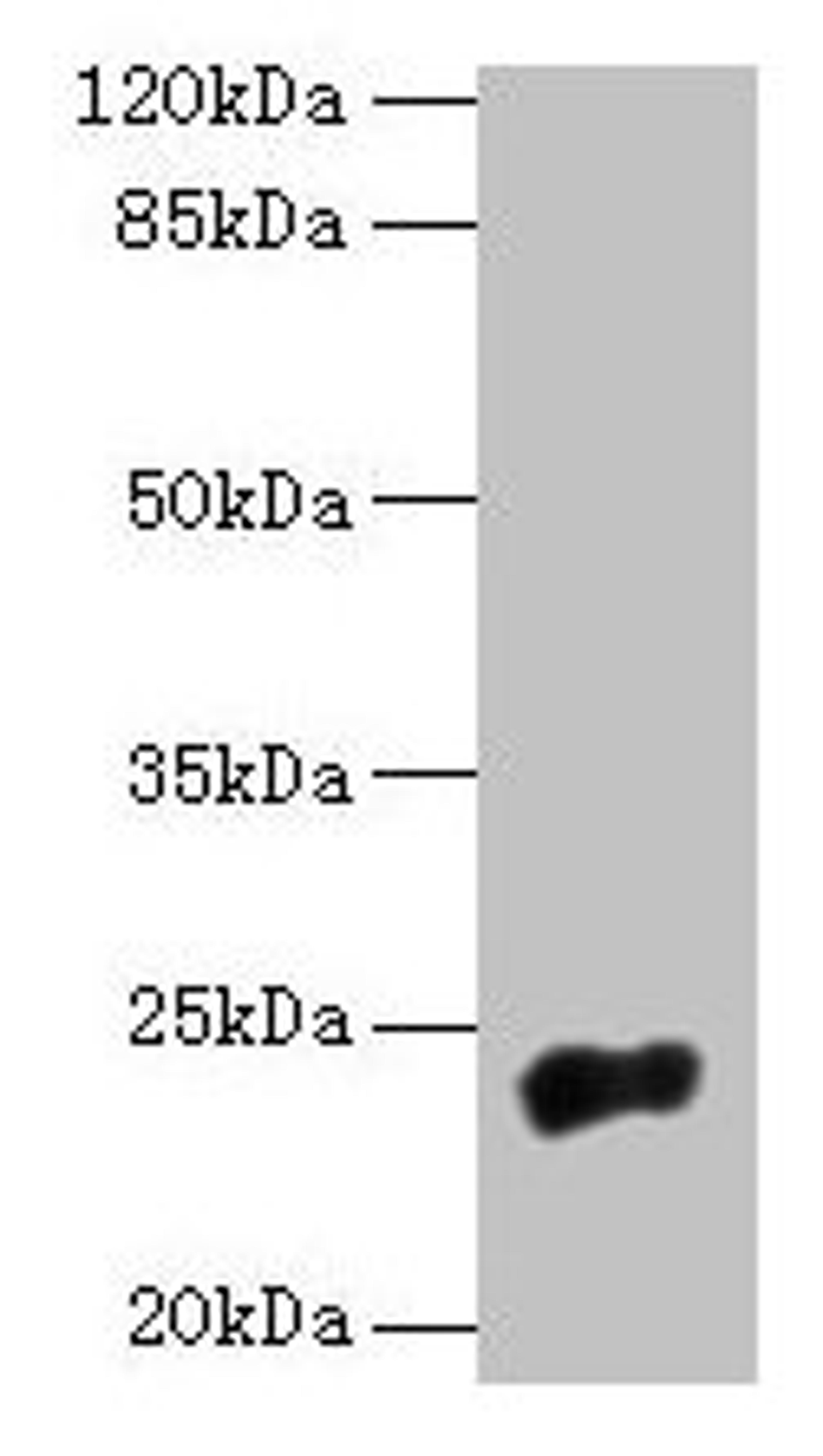 Western blot. All lanes: NACA2 antibody at 5µg/ml + 293T whole cell lysate. Secondary. Goat polyclonal to rabbit IgG at 1/10000 dilution. Predicted band size: 24 kDa. Observed band size: 24 kDa