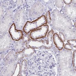 Immunohistochemistry: SAP25 Antibody [NBP2-32365] - Immunohistochemical staining of human kidney shows strong cytoplasmic positivity in cells in tubules.