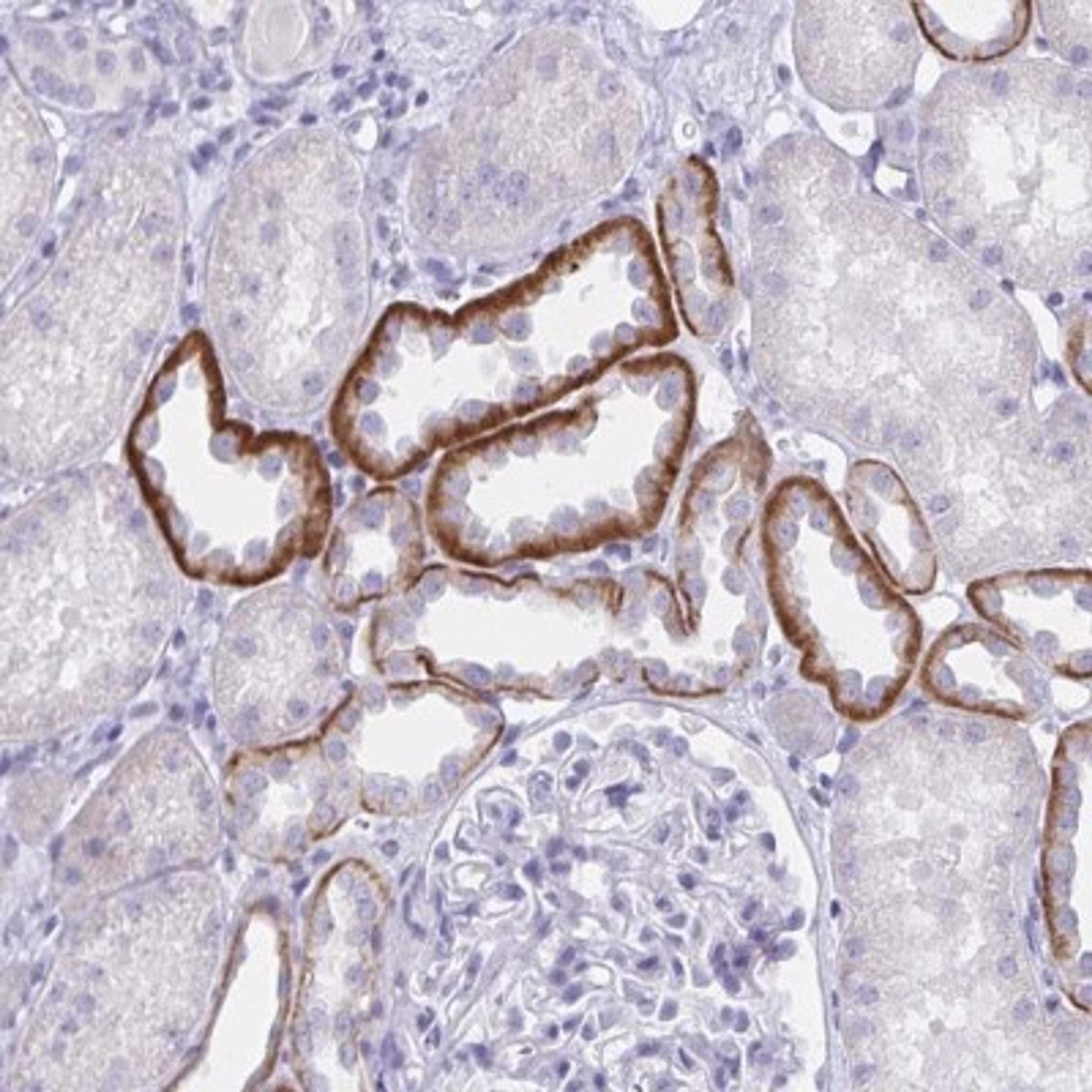 Immunohistochemistry: SAP25 Antibody [NBP2-32365] - Immunohistochemical staining of human kidney shows strong cytoplasmic positivity in cells in tubules.