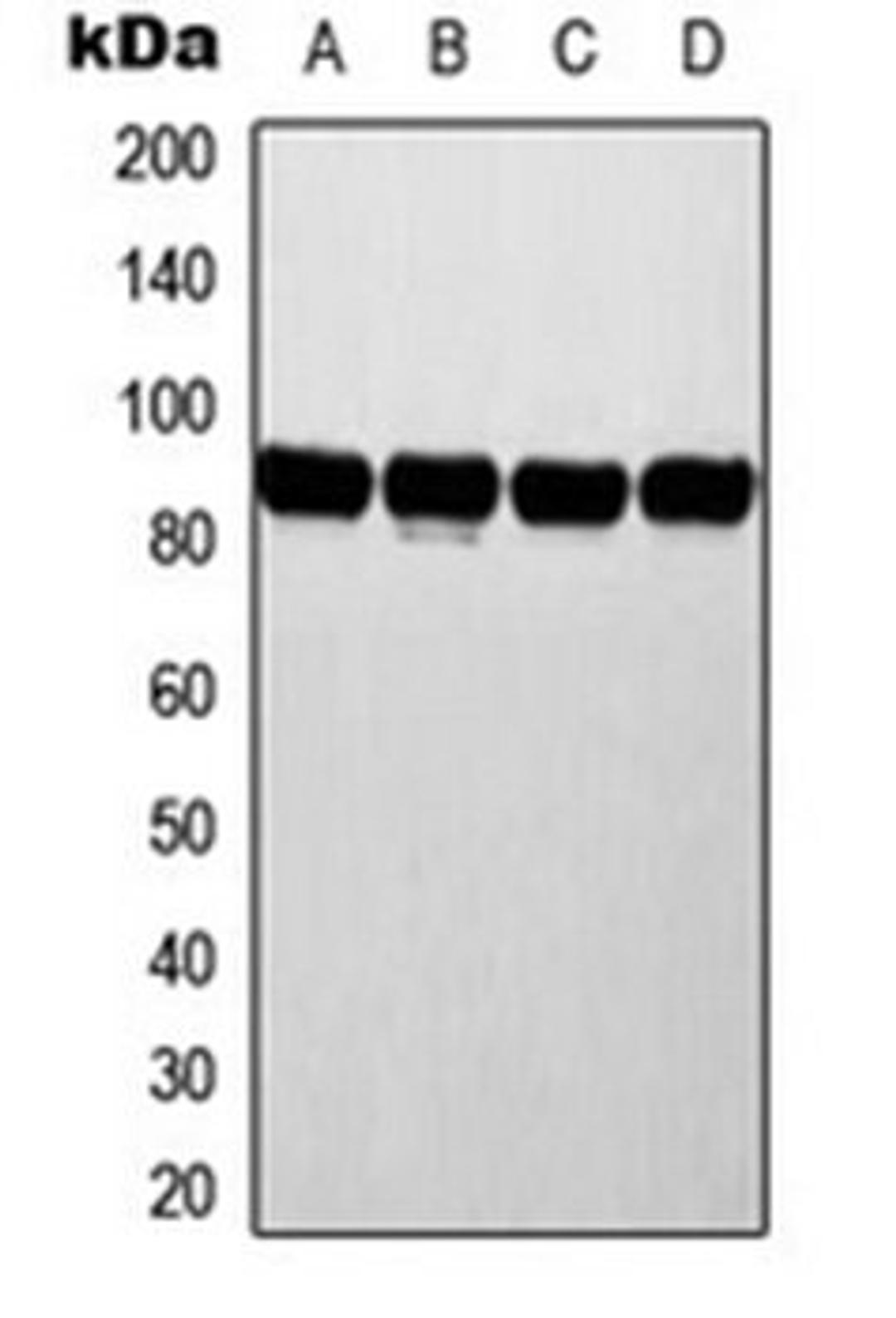 Western blot analysis of MCF7 (Lane 1), HeLa (Lane 2), NIH3T3 (Lane 3), rat liver (Lane 4) whole cell lysates using ATRIP antibody