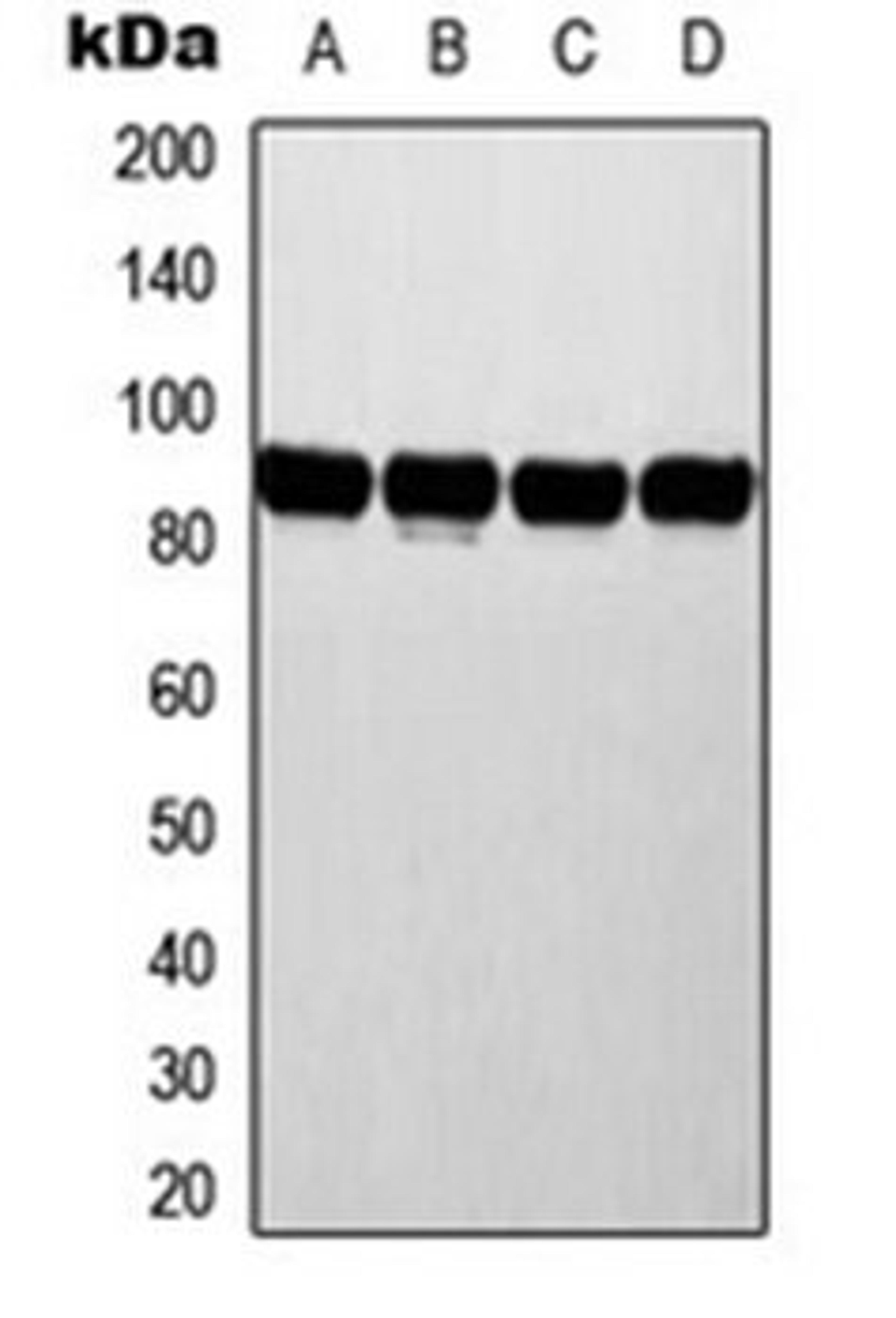 Western blot analysis of MCF7 (Lane 1), HeLa (Lane 2), NIH3T3 (Lane 3), rat liver (Lane 4) whole cell lysates using ATRIP antibody