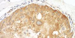 Detection of human Septin 9 by immunohistochemistry.