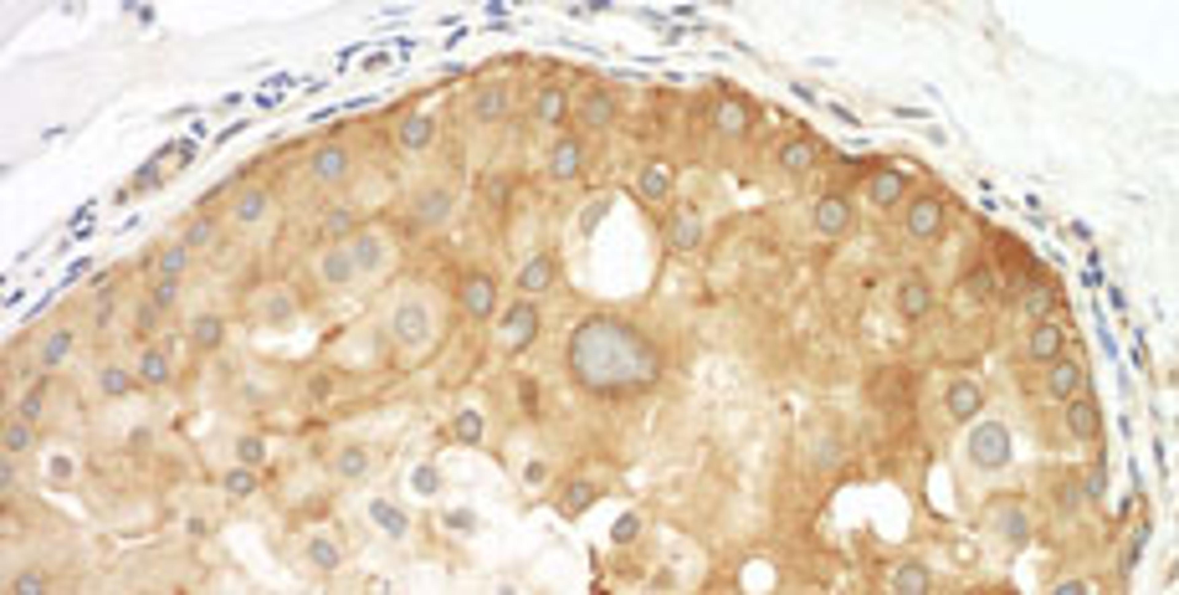 Detection of human Septin 9 by immunohistochemistry.