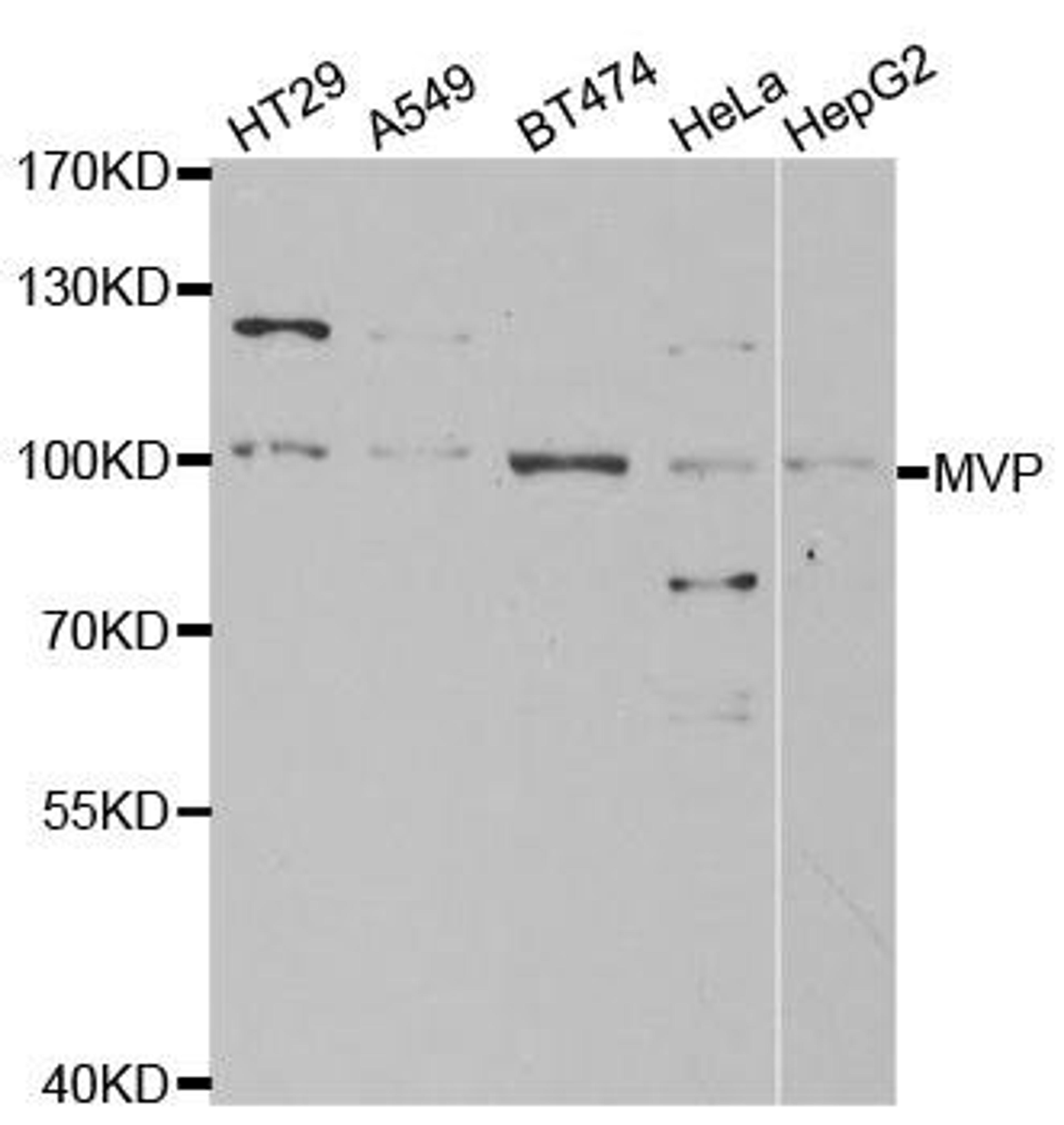 Western blot analysis of extracts of various cell lines using MVP antibody