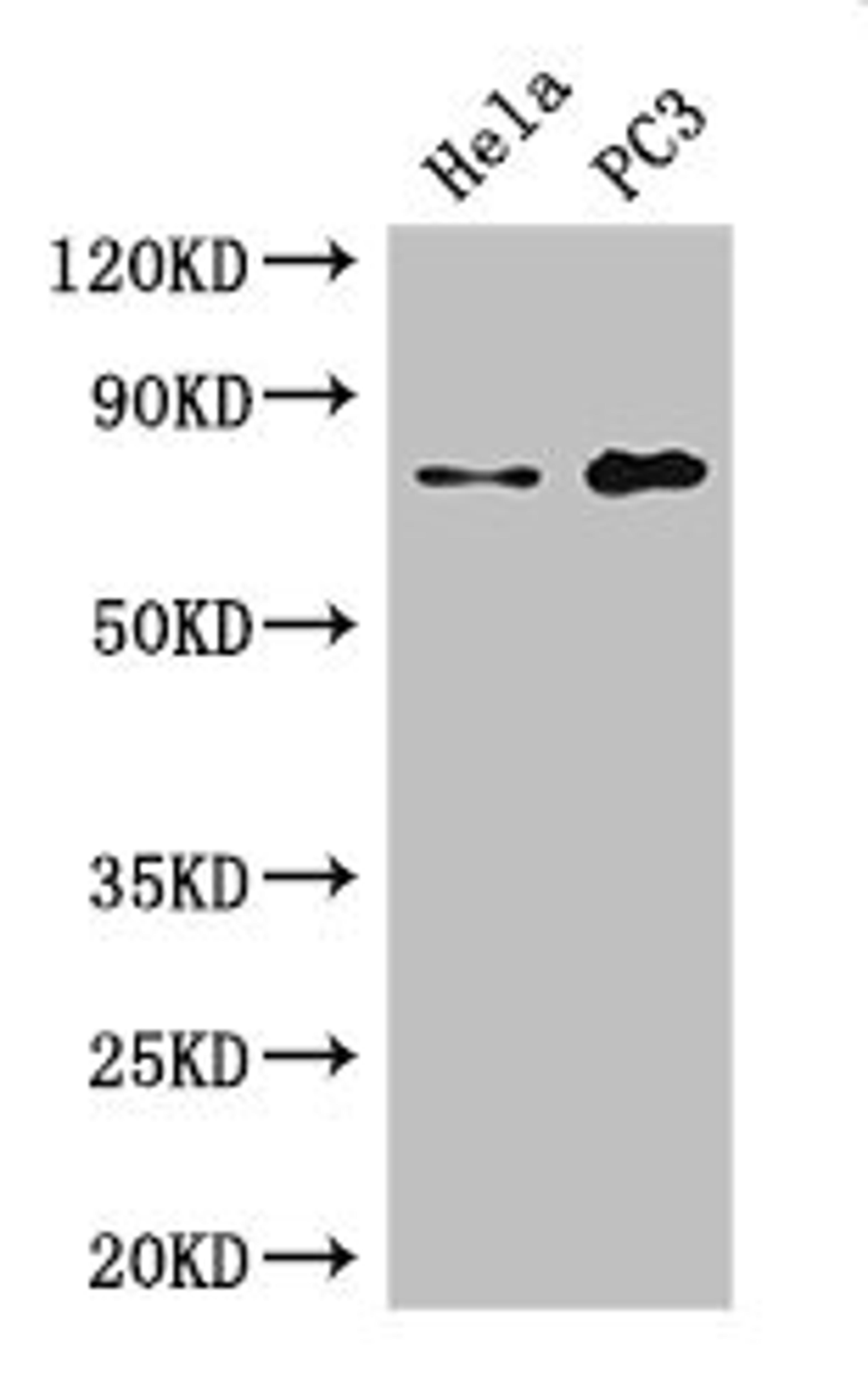 Western Blot. Positive WB detected in: Hela whole cell lysate, PC-3 whole cell lysate. All lanes: STRBP antibody at 2.7µg/ml. Secondary. Goat polyclonal to rabbit IgG at 1/50000 dilution. Predicted band size: 74, 72 kDa. Observed band size: 74 kDa