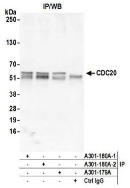 Detection of human CDC20 by western blot of immunoprecipitates.