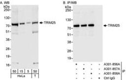 Detection of human TRIM25 by western blot and immunoprecipitation.