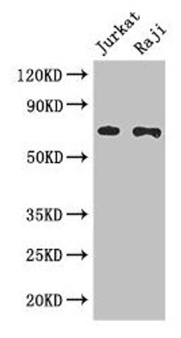 Western Blot. Positive WB detected in: Jurkat whole cell lysate, Raji whole cell lysate. All lanes: CDC25B antibody at 3µg/ml. Secondary. Goat polyclonal to rabbit IgG at 1/50000 dilution. Predicted band size: 65, 64, 61, 68 kDa. Observed band size: 65 kDa