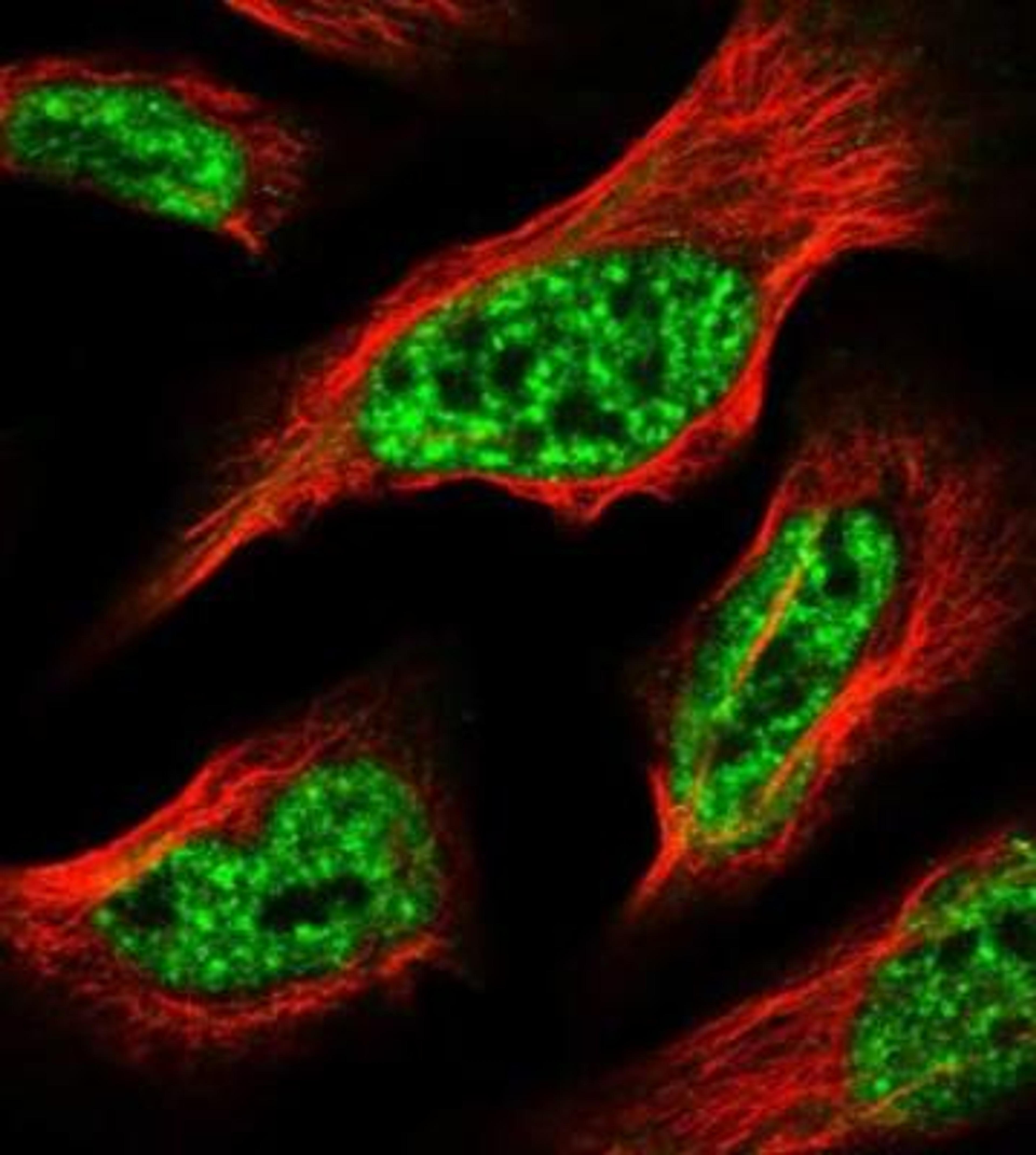 Immunocytochemistry/Immunofluorescence: IRG1 Antibody [NBP2-14839] - Staining of human cell line U-2 OS shows positivity in nucleus but excluded from the nucleoli.