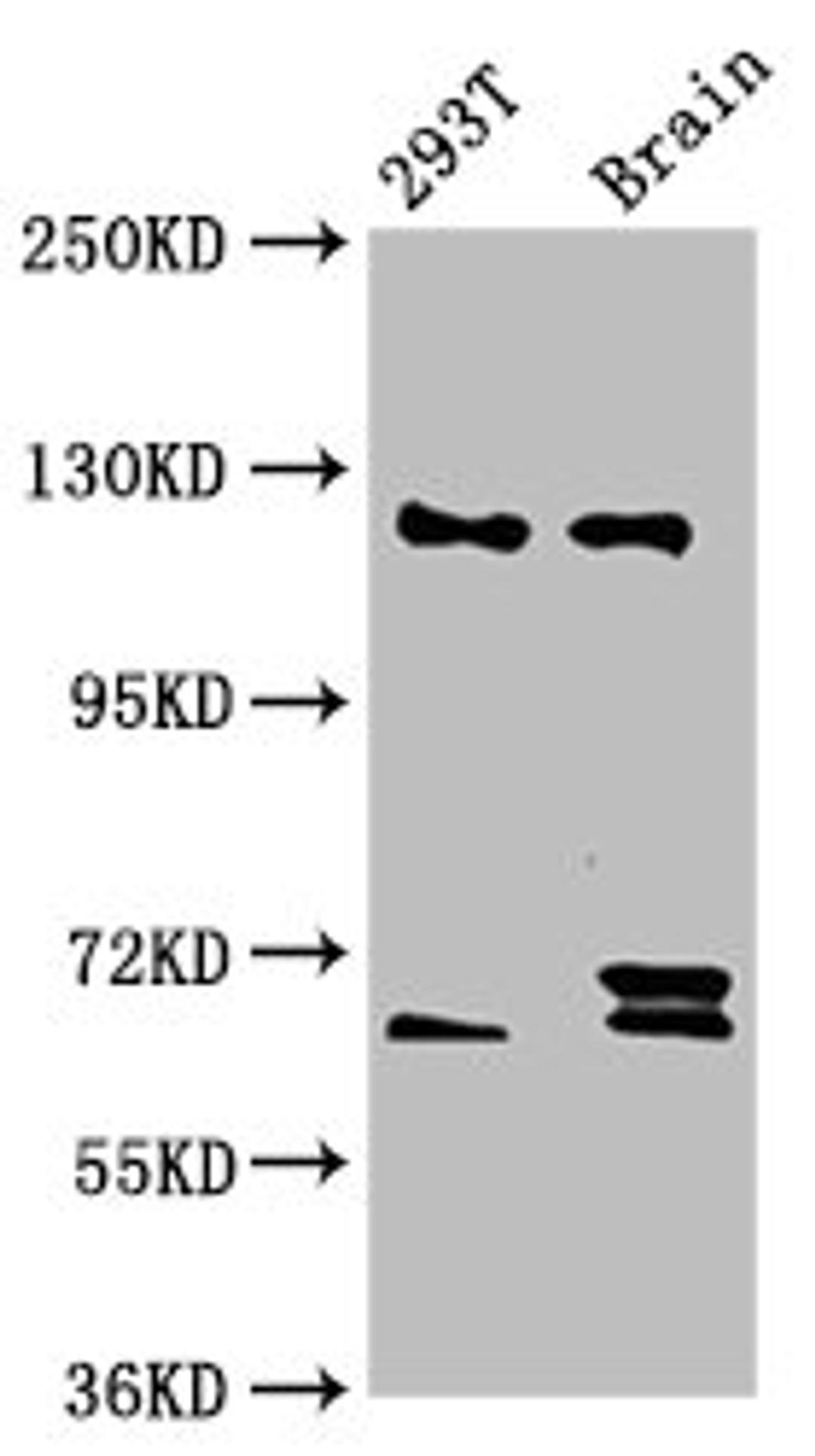 Western Blot. Positive WB detected in: 293T whole cell lysate, Rat brain tissue. All lanes: TCERG1 antibody at 5.9ug/ml. Secondary. Goat polyclonal to rabbit IgG at 1/50000 dilution. Predicted band size: 124, 122 kDa. Observed band size: 124 kDa.