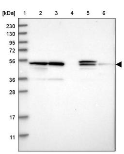 Western Blot: PSMD12 Antibody [NBP1-87801] - Lane 1: Marker [kDa] 230, 130, 95, 72, 56, 36, 28, 17, 11<br/>Lane 2: Human cell line RT-4<br/>Lane 3: Human cell line U-251MG sp<br/>Lane 4: Human plasma (IgG/HSA depleted)<br/>Lane 5: Human liver tissue<br/>Lane 6: Human tonsil tissue