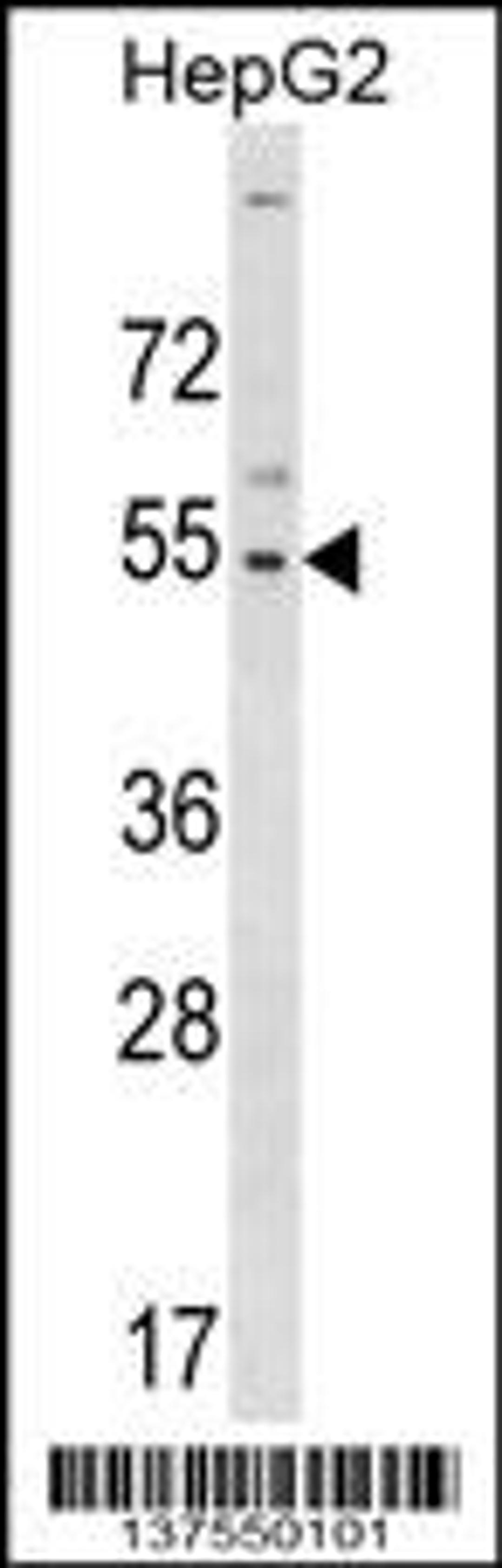 Western blot analysis in HepG2 cell line lysates (35ug/lane).