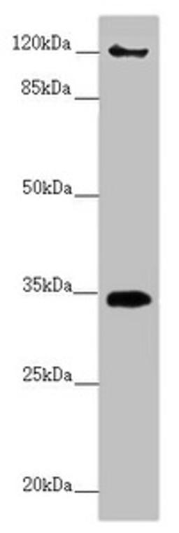 Western blot. All lanes: FBXO6 antibody at 3.87 ug/ml + A431 whole cell lysate. Secondary. Goat polyclonal to rabbit IgG at 1/10000 dilution. Predicted band size: 34 kDa. Observed band size: 34, 120 kDa. 