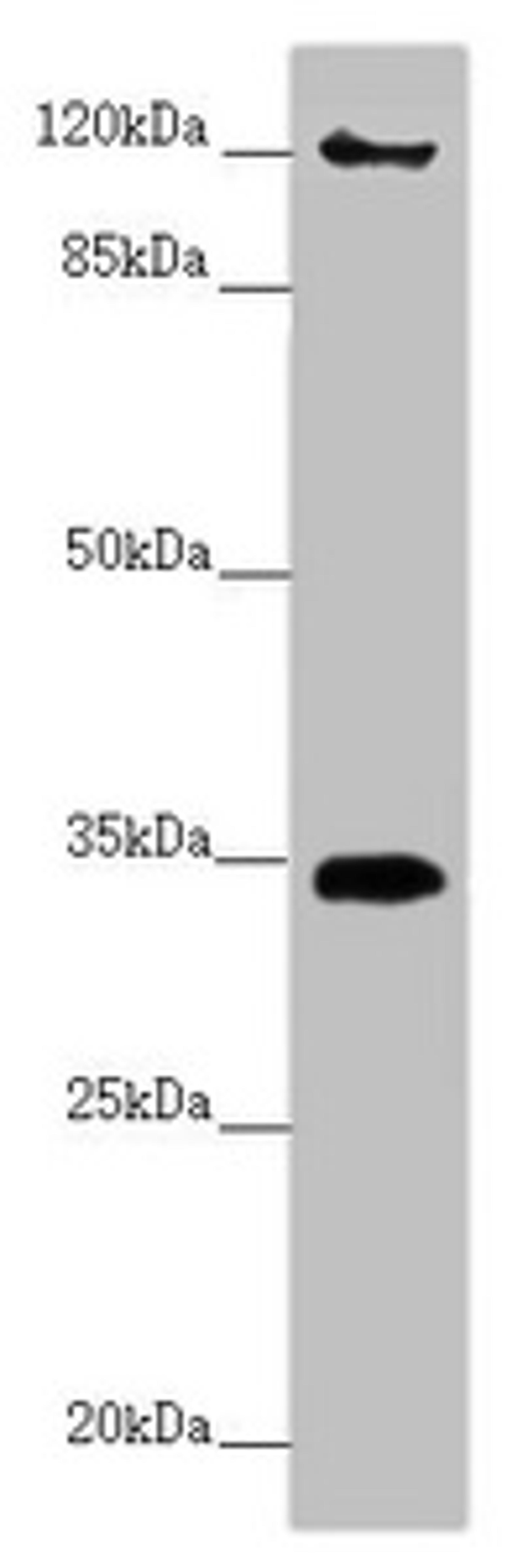 Western blot. All lanes: FBXO6 antibody at 3.87 ug/ml + A431 whole cell lysate. Secondary. Goat polyclonal to rabbit IgG at 1/10000 dilution. Predicted band size: 34 kDa. Observed band size: 34, 120 kDa. 
