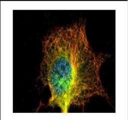 Immunocytochemistry/Immunofluorescence: alpha Tubulin 4a Antibody [NBP2-21604] - Confocal immunofluorescence analysis of methanol-fixed HeLa, using alpha Tubulin 4a antibody (green) at 1:500 dilution. Alpha-tubulin filaments are labeled with Alpha-tubulin antibody (Red) at 1:2500.