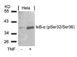 Western blot analysis of lysed extracts from HeLa cells untreated or treated with TNF using I&#954;B-&#945; (Phospho-Ser32/Ser36).