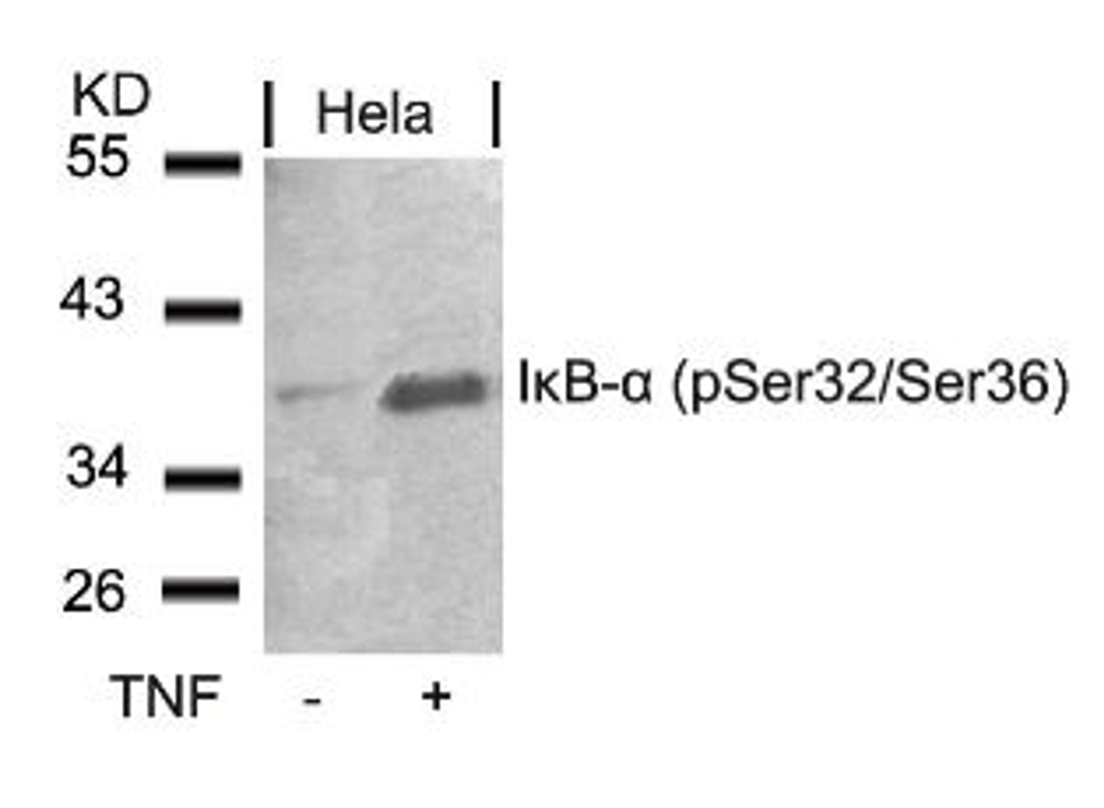 Western blot analysis of lysed extracts from HeLa cells untreated or treated with TNF using I&#954;B-&#945; (Phospho-Ser32/Ser36).