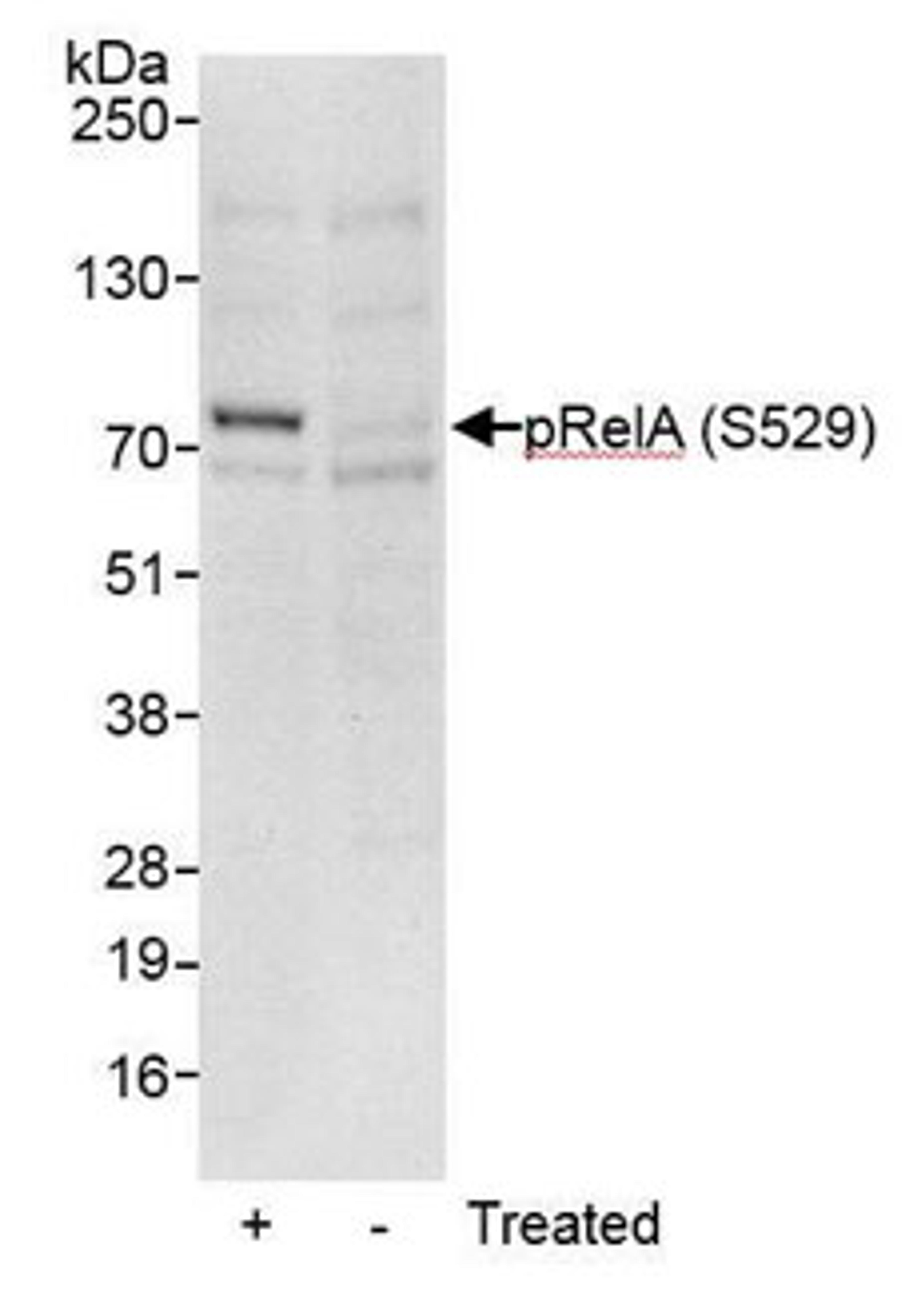 Detection of human Phospho RelA (S529) by western blot.