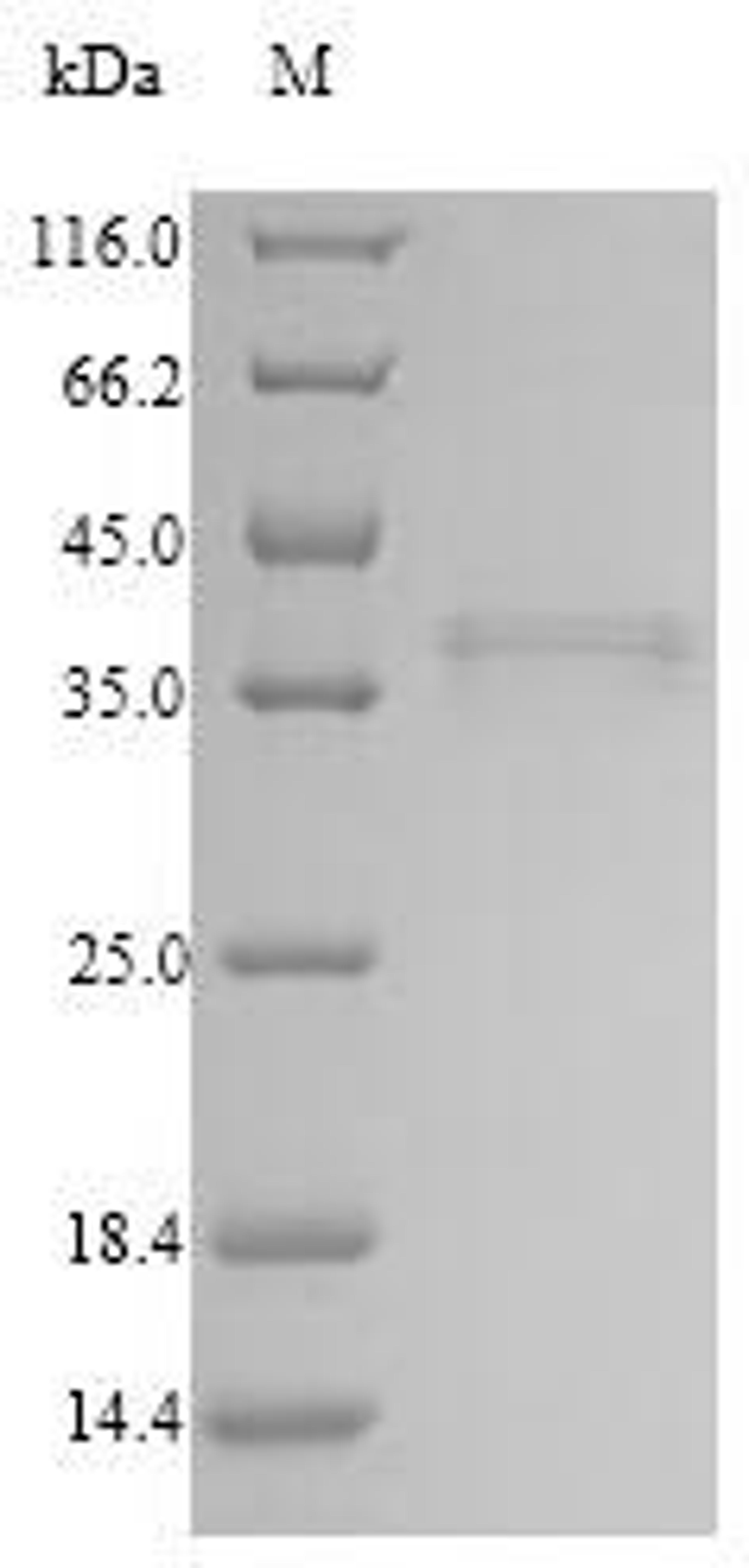 (Tris-Glycine gel) Discontinuous SDS-PAGE (reduced) with 5% enrichment gel and 15% separation gel.