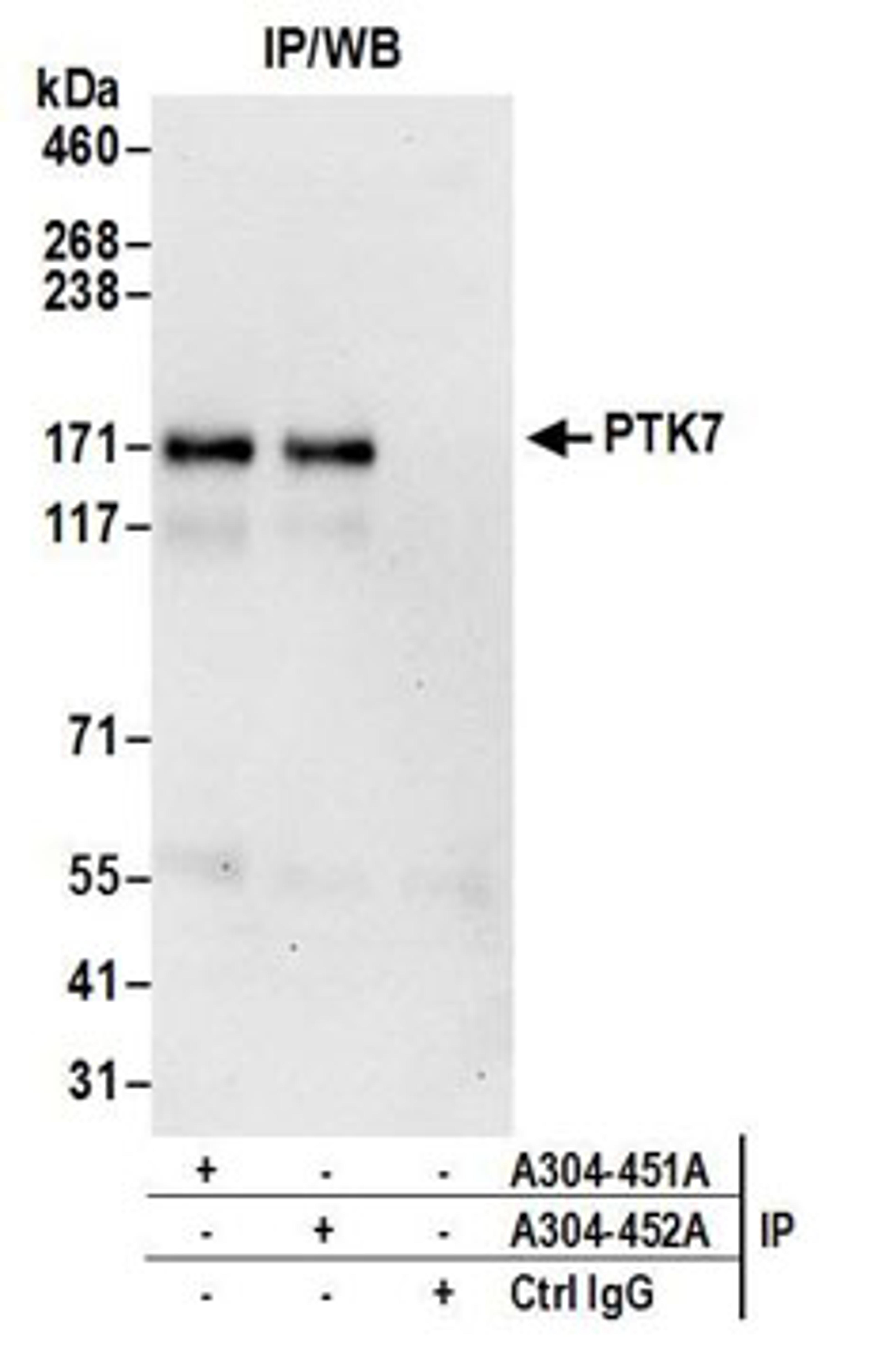 Detection of human PTK7 by western blot of immunoprecipitates.