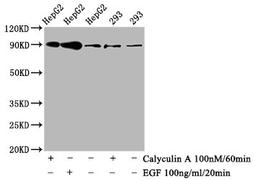 Western Blot. Positive WB detected in HepG2 whole cell lysate,293 whole cell lysate(treated with Calyculin A or EGF). All lanes Phospho-NFE2L2 antibody at 0.8μg/ml. Secondary. Goat polyclonal to rabbit IgG at 1/50000 dilution. Predicted band size: 90 KDa. Observed band size: 90 KDa. 