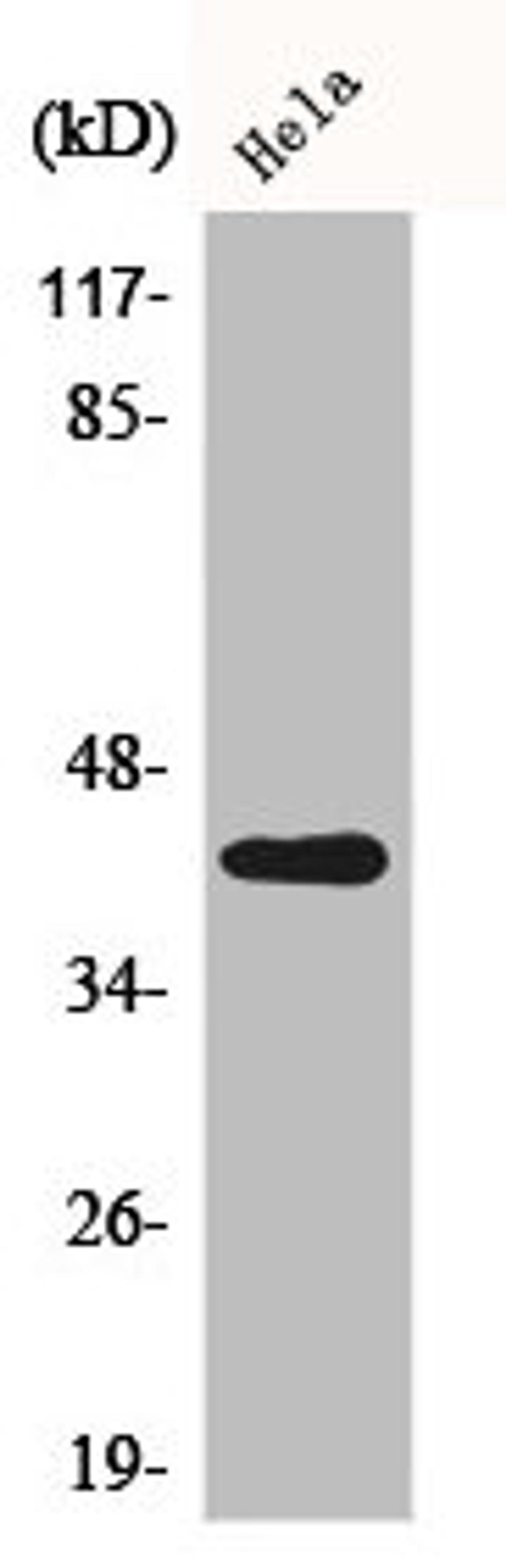 Western Blot analysis of Hela cells using Actin β Polyclonal Antibody