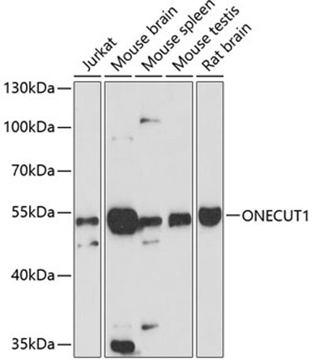 Western blot - ONECUT1 antibody (A12774)