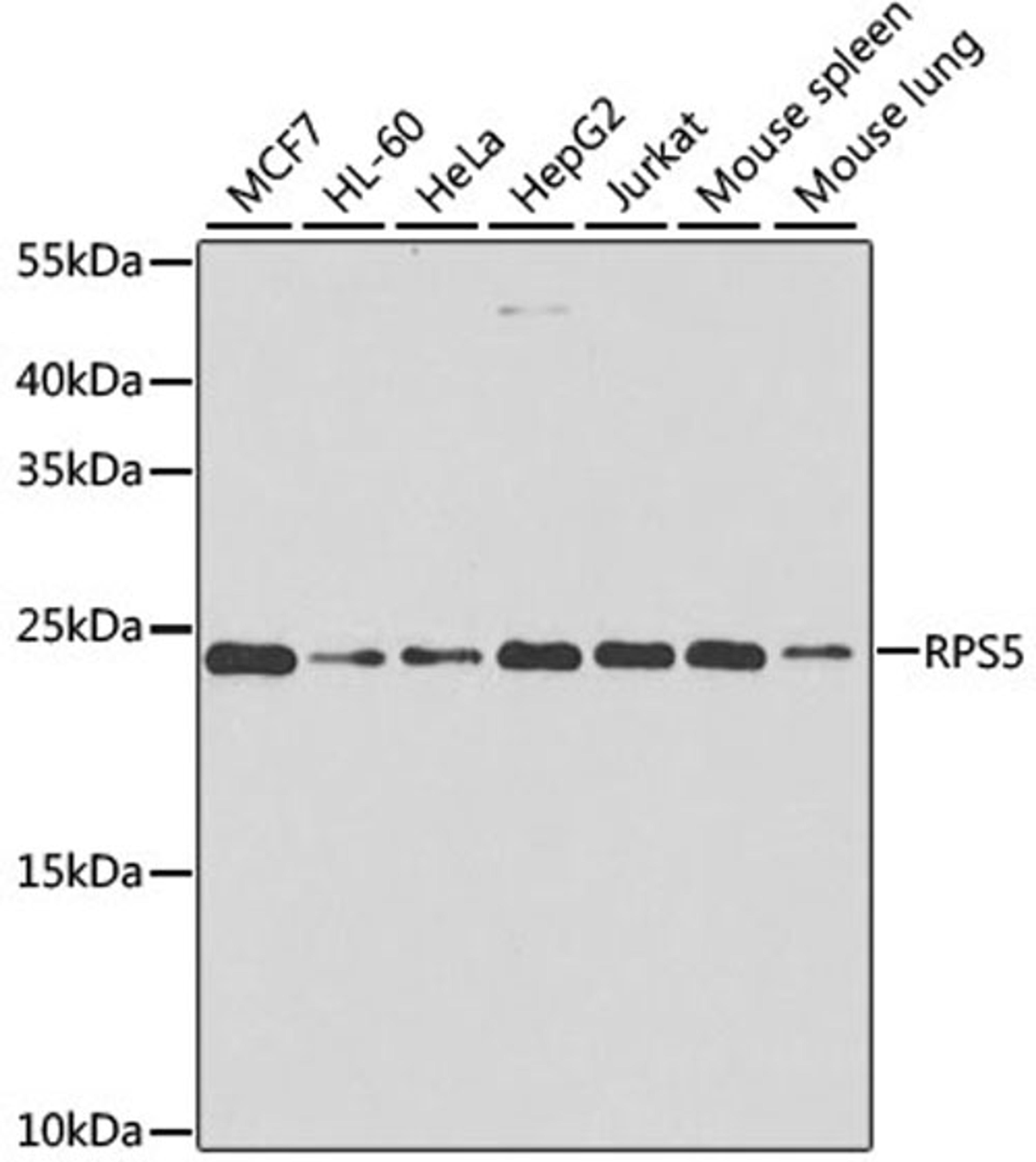 Western blot - RPS5 antibody (A6975)