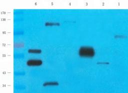 WB analysis of rat lung (lane 1), mouse testis (lane 2), human lung cancer (lane 3), hela (lane 4), mouse spleen (lane 5), mouse liver (lane 6) tissue using Cox2 antibody (1 ug/ml )