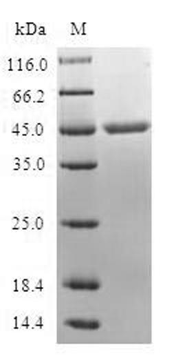 (Tris-Glycine gel) Discontinuous SDS-PAGE (reduced) with 5% enrichment gel and 15% separation gel.