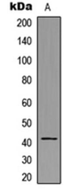 Western blot analysis of A431 (Lane1) whole cell using HLA-H antibody