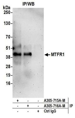 Detection of human MTFR1 by WB of IP.